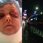 Tânără română de 28 de ani bătută cu sălbăticie de carabinieri. Vinovații identificați și puși sub acuzație după 2 ani la insistențele avocatului Marco Crocitta