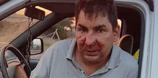 Italia: Zidar român bătut de 7 persoane pentru că le-a cerut să nu arunce deșeuri în parc