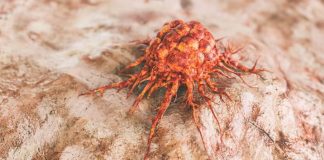 Cercetătorii italieni: Fără zahăr în organism cancerul „moare de foame”