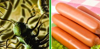 Italian mort după ce a mâncat crenvurști, al patrulea caz de deces provocat de o bacterie periculoasă