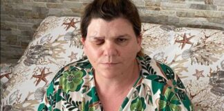 Coșmarul unei românce din Italia, rănită de un vecin: „Mi-e atât de teamă, că m-am gândit să mă arunc de la balcon”