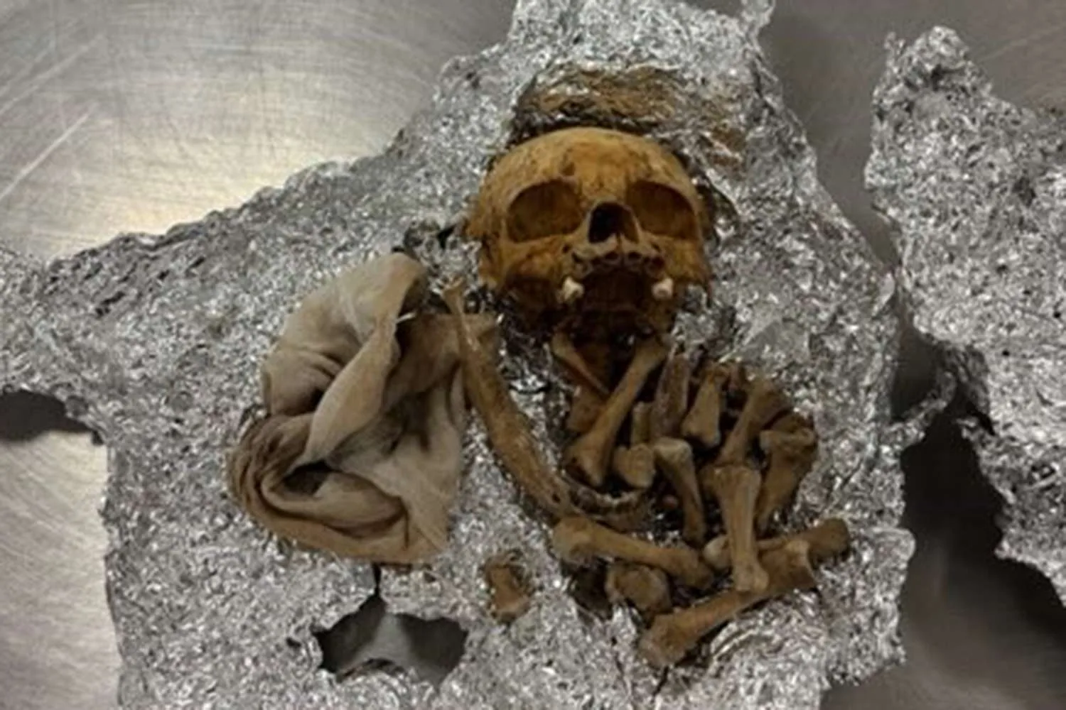 Human-skull-Florida-airport-092025-02-389c7127a86e407cb8f0ef521d077b02