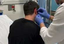 Adolescent de 17 ani din Italia merge la Urgențe cu o rană în spatele urechii, medicii îi găsesc un glonț în cap 1